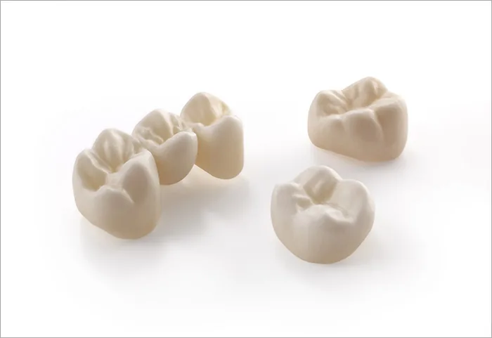 Vollkeramikkronen aus Zirkonoxid